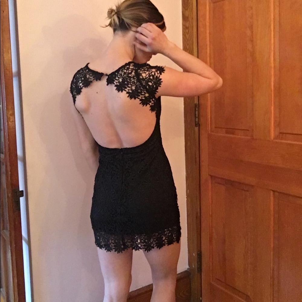 Open back lace minidress